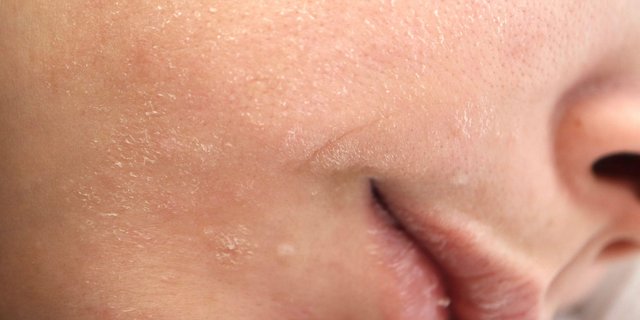 Understanding the Signs of Sensitive Skin and How to Treat It Right